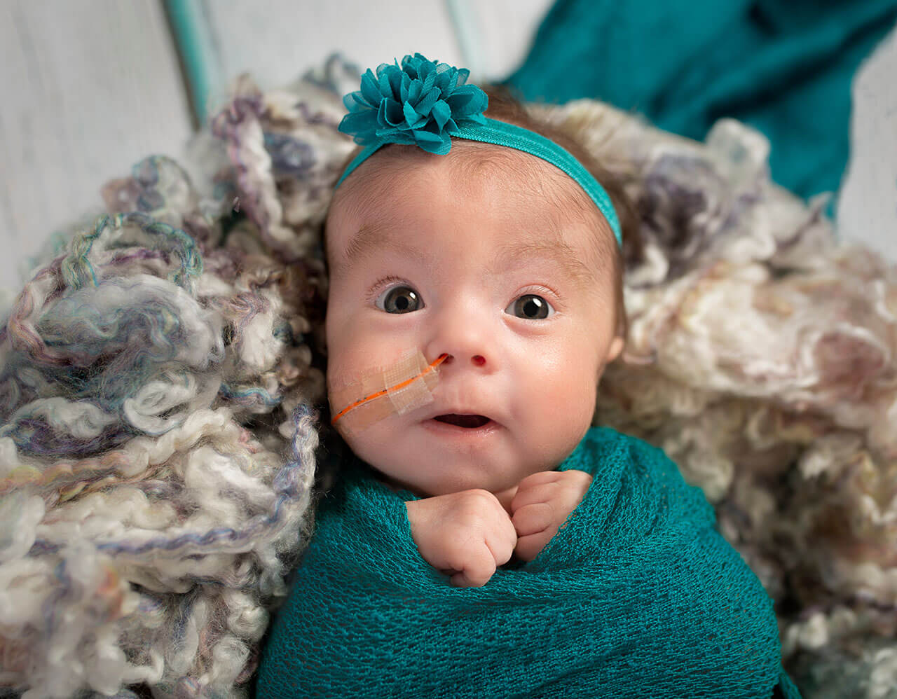 Adorable three month old special needs infant girl with teal bow