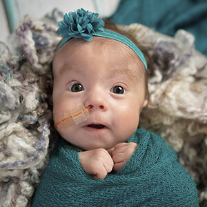 Tiny baby girl with feeding tube