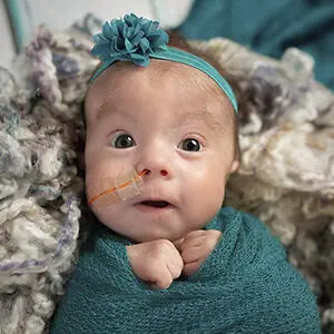 Tiny baby girl with feeding tube