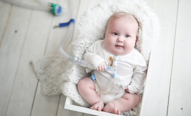 Can You Go Home with a Tracheostomy?